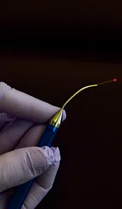 LANAP laser